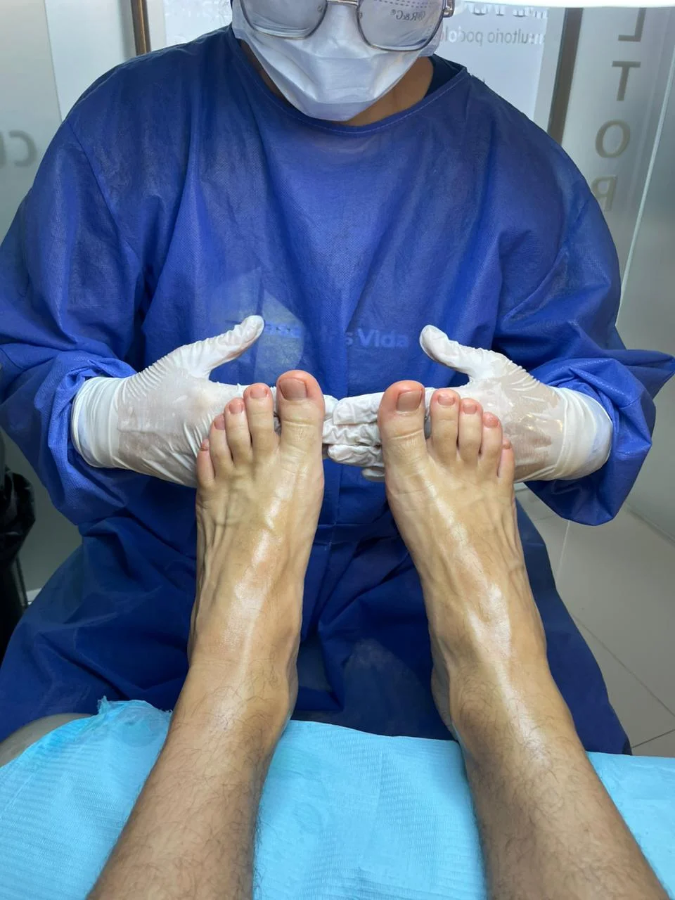 Profilaxis podal en Necvoe